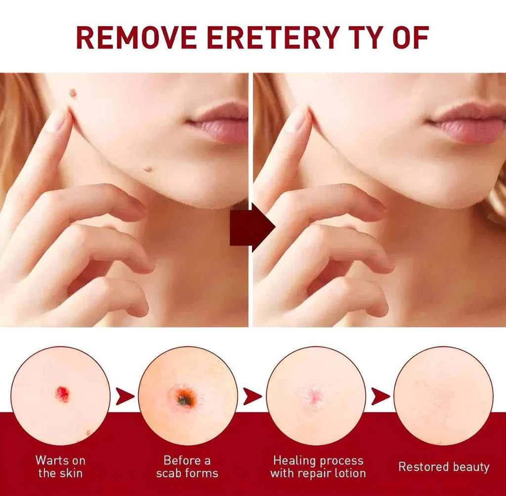 Tags & Moles Remover BUY 1 GET 1 FREE