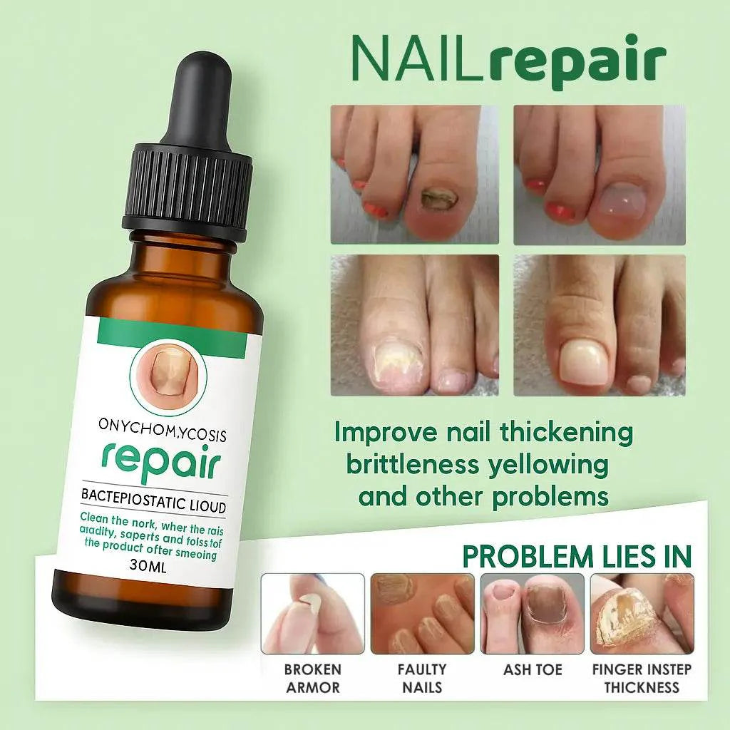 Nail Serum for Long healthy & fungus free nails