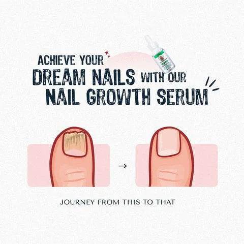 Nail Serum for Long healthy & fungus free nails