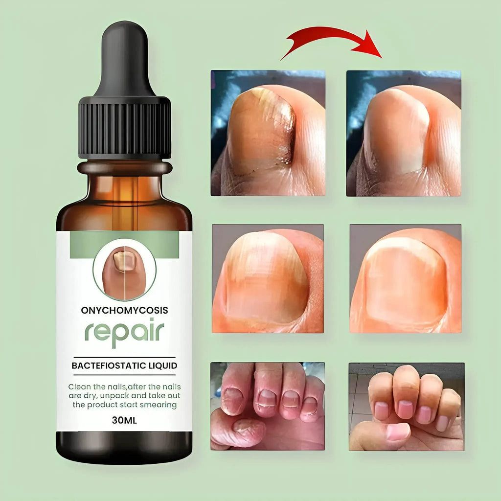Nail Serum for Long healthy & fungus free nails